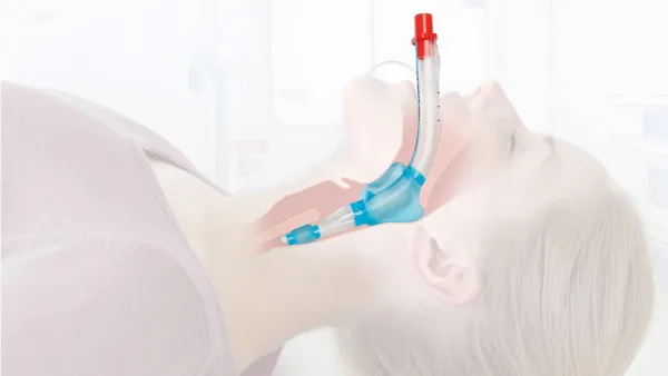 Einmal-Larynx-Tubus LTS-D Einzel Set Gr. 4 rot fr Erwachsene 155 -180 cm