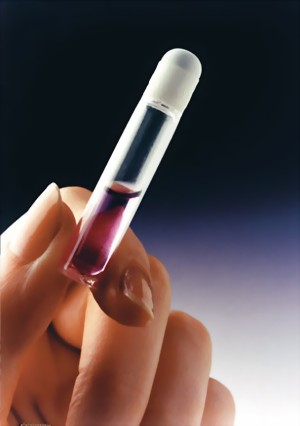 DERMABOND HVD Hautkleber, 6 x 0,5 ml Ampullen