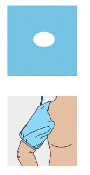 Einmal Tourniquet Drape für Blutleeremanschetten (10 Stück) Klein, steril verpackt